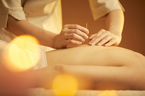 针灸