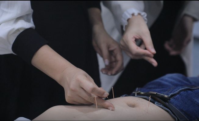 针灸