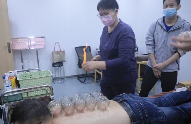 拔罐学习 拔罐学习