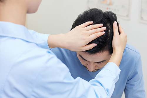 脱发白发 脱发白发