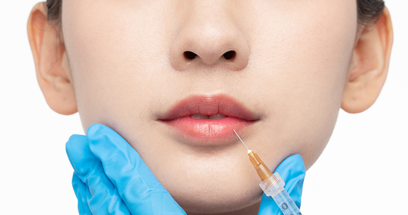 玻尿酸注射 玻尿酸注射