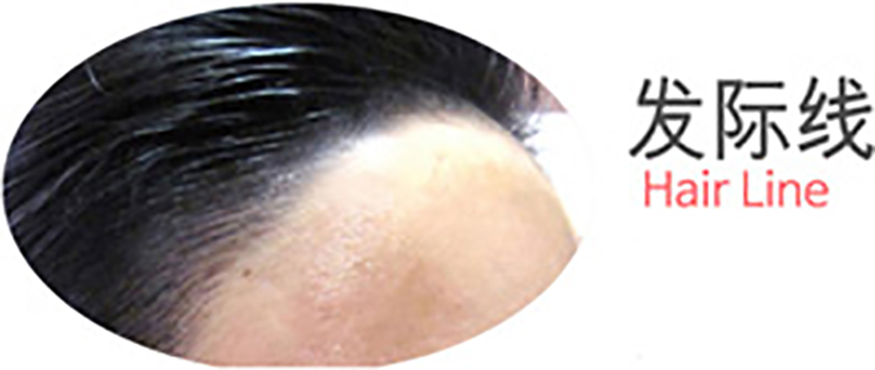 發(fā)際線(xiàn) 發(fā)際線(xiàn)