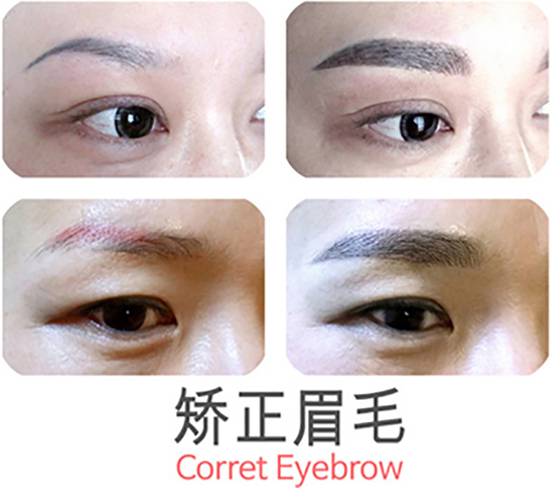 矯正眉毛 矯正眉毛