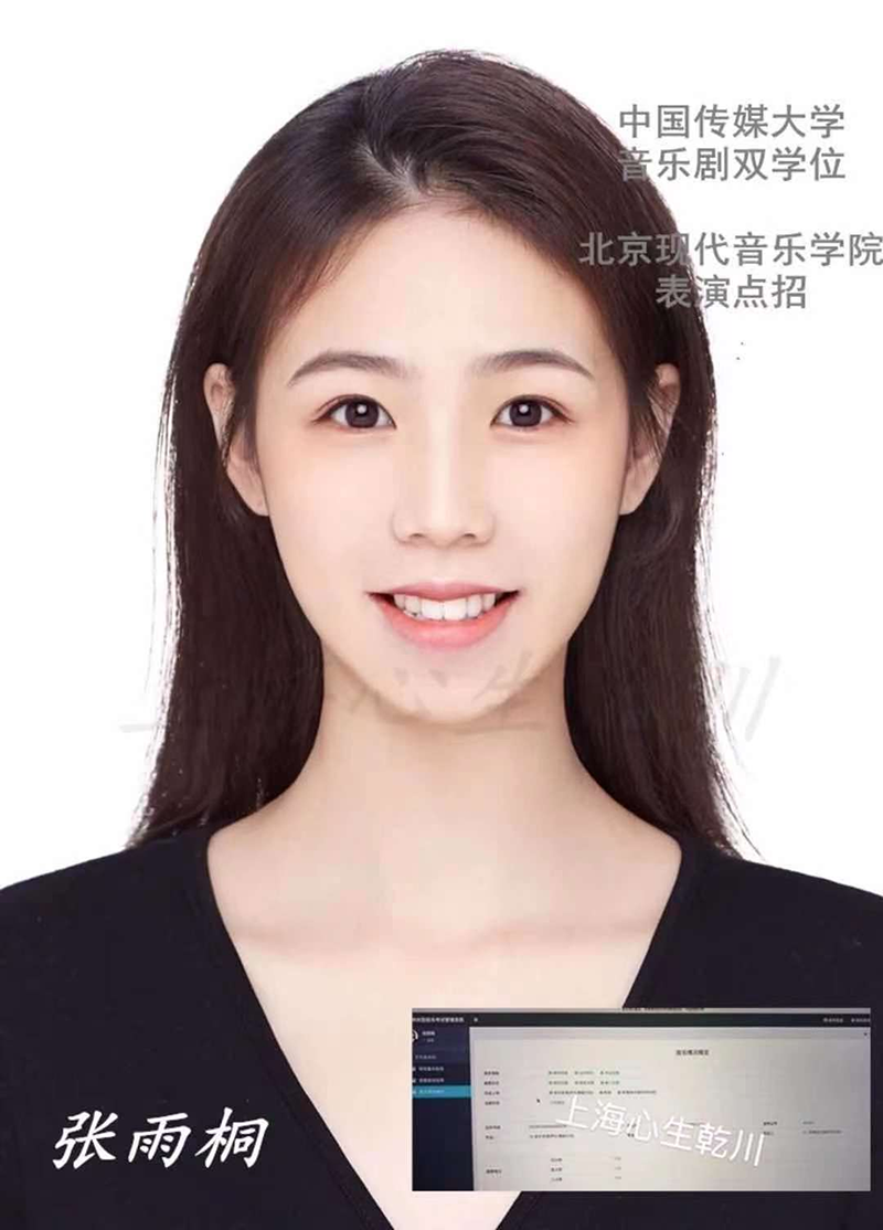 张雨桐 张雨桐