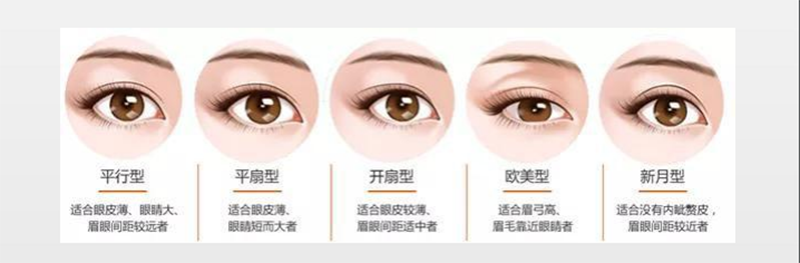 双眼皮类型图 双眼皮类型图