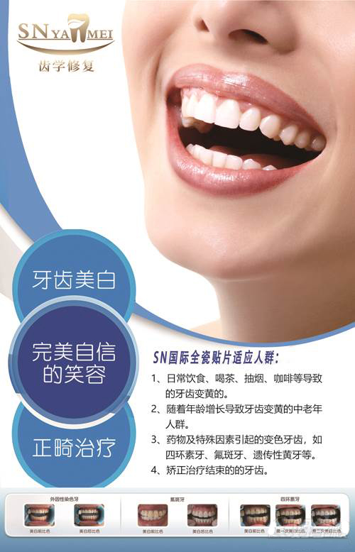 进口纳米树脂美牙贴面 进口纳米树脂美牙贴面