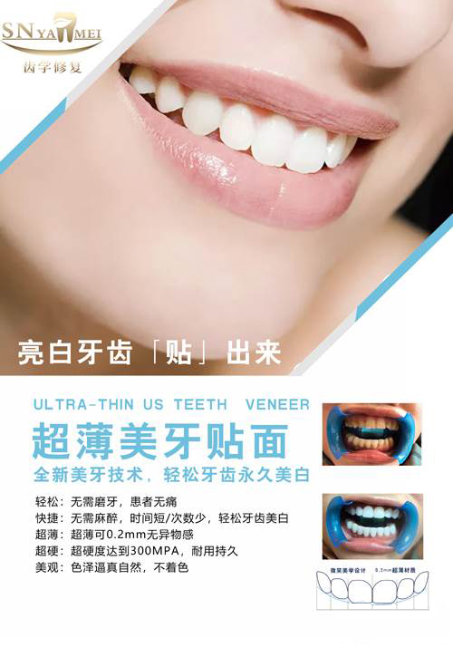 私人定制全美牙瓷贴面培训 私人定制全美牙瓷贴面培训