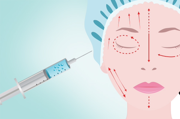 微整形注射 微整形注射