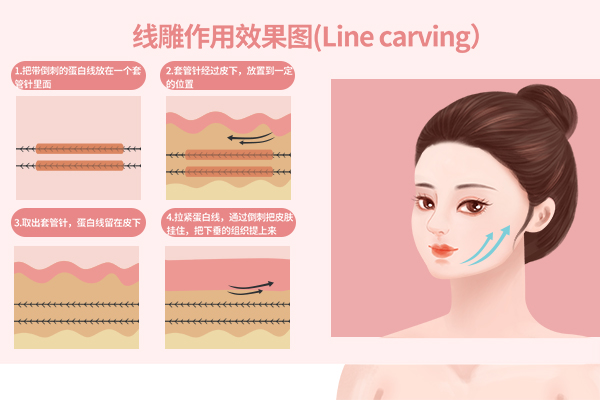 線雕效果 線雕效果