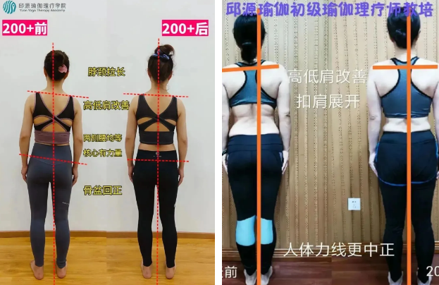 前后对比 前后对比