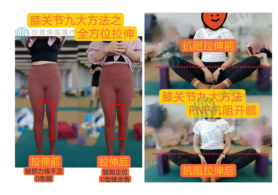 抗阻拉伸后 抗阻拉伸后