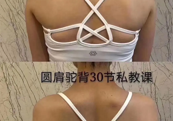 圆肩驼背矫正 圆肩驼背矫正
