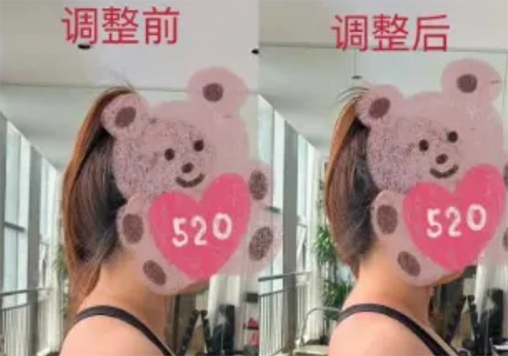 调整前后 调整前后